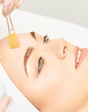 Peeling personnalisé